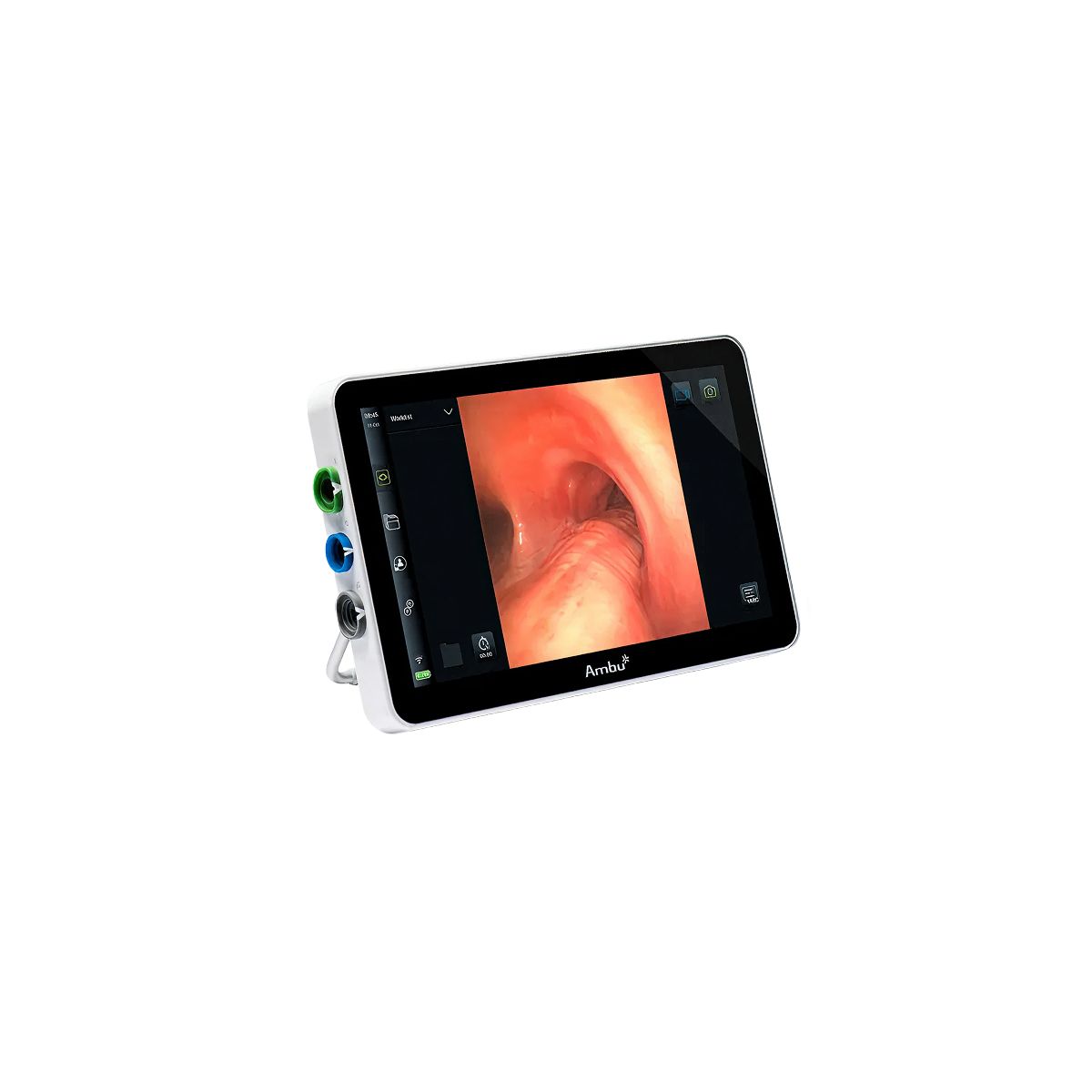Ambu® aView™ 2 Advance (Gen2) — Monitor de visualización para endoscopia