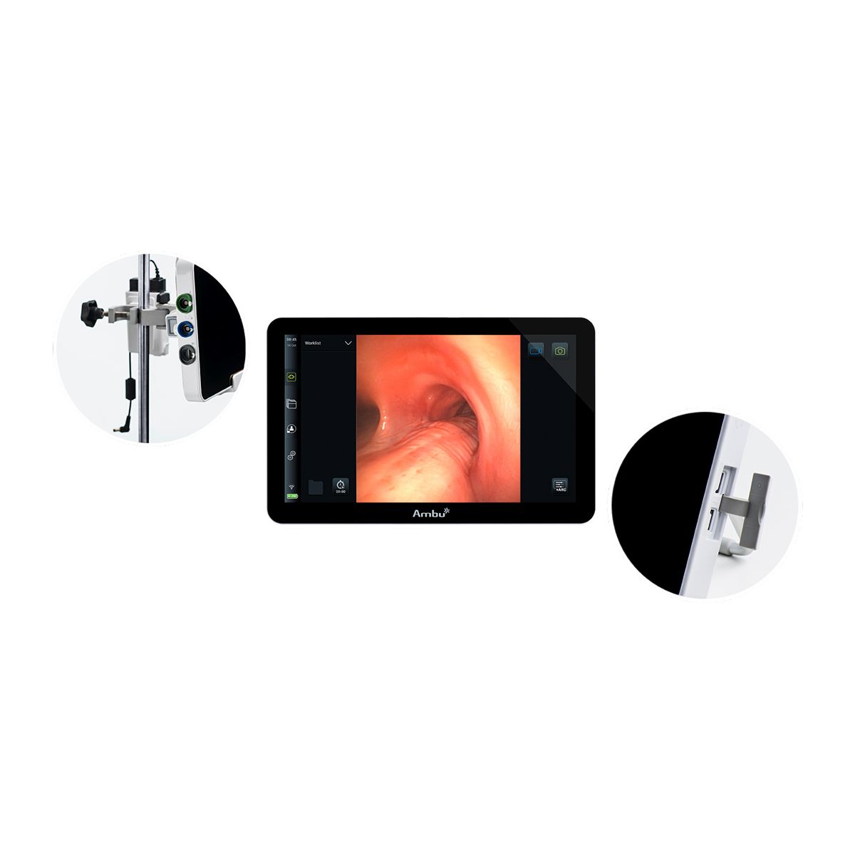 Ambu® aView™ 2 Advance (Gen2) — Monitor de visualización para endoscopia
