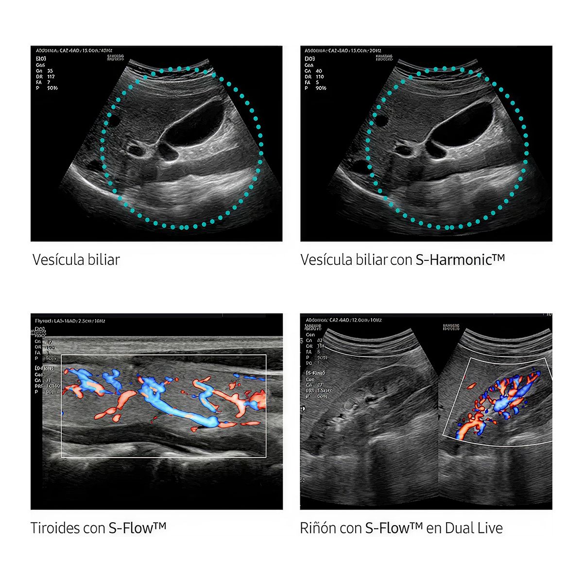 HM70 EVO — Ultrasonido portátil de alto desempeño