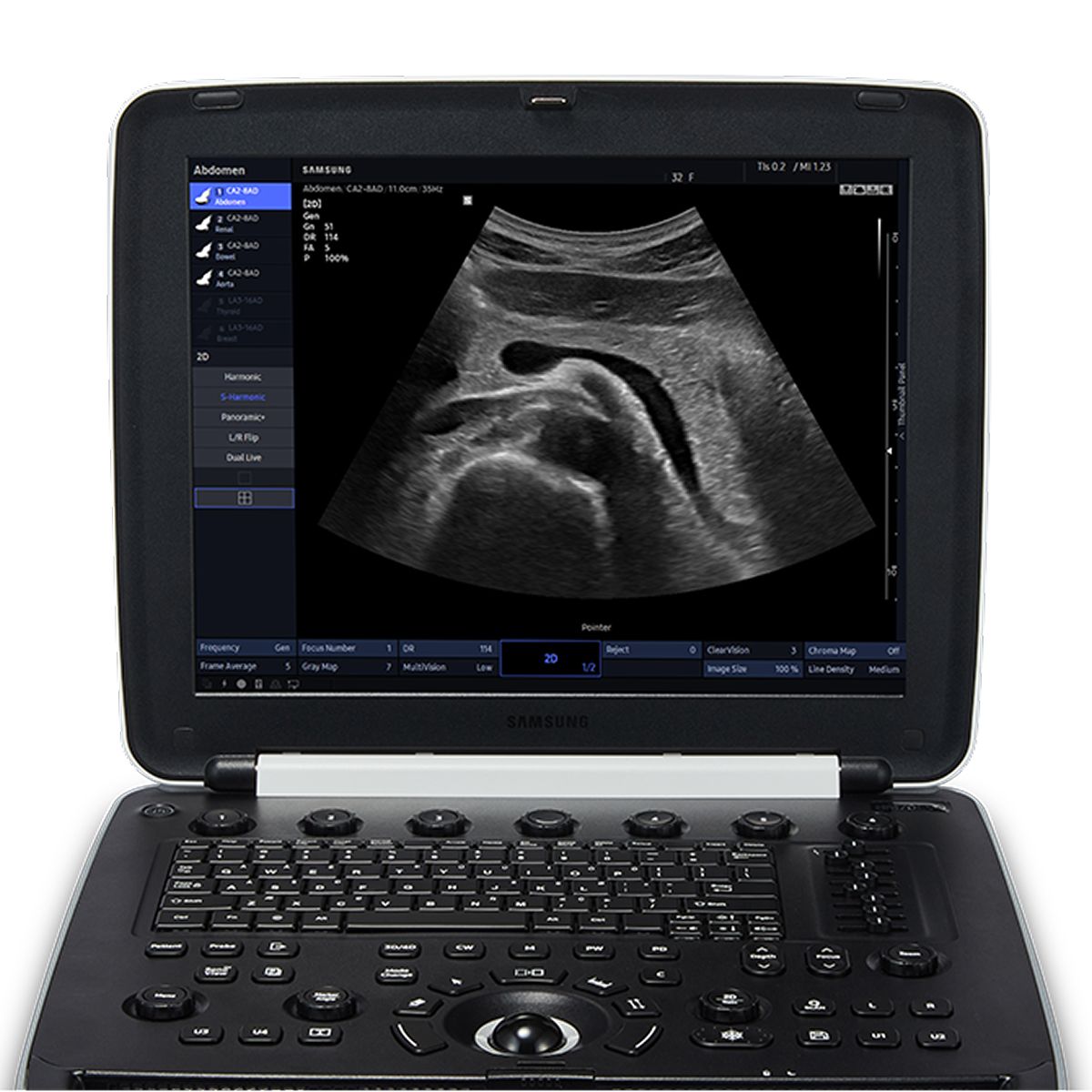 HM70 EVO — Ultrasonido portátil de alto desempeño