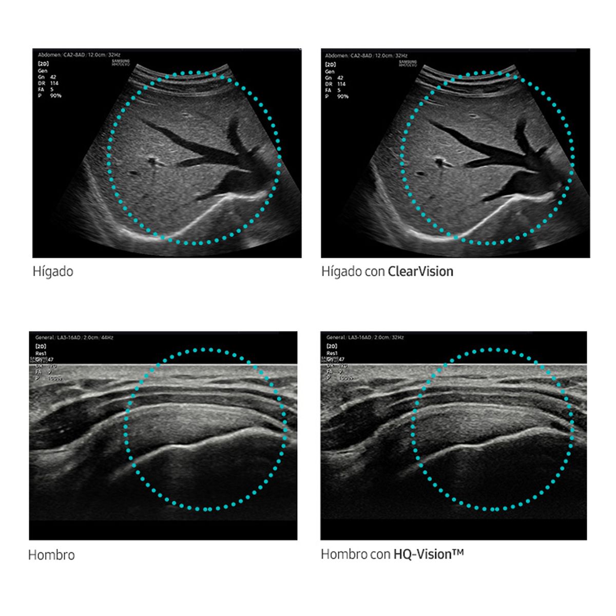 HM70 EVO — Ultrasonido portátil de alto desempeño
