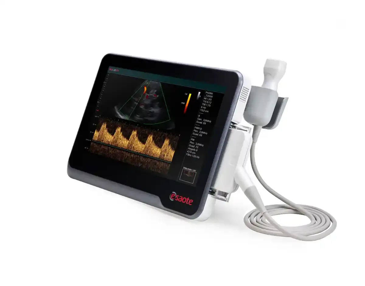 MyLab X1 – Ultrasonido portátil ultraligero