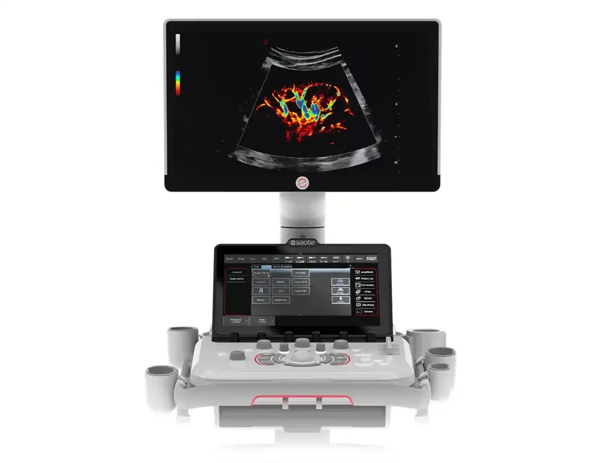 MyLab A50 – Ecografía cardiovascular avanzada - Vista 13
