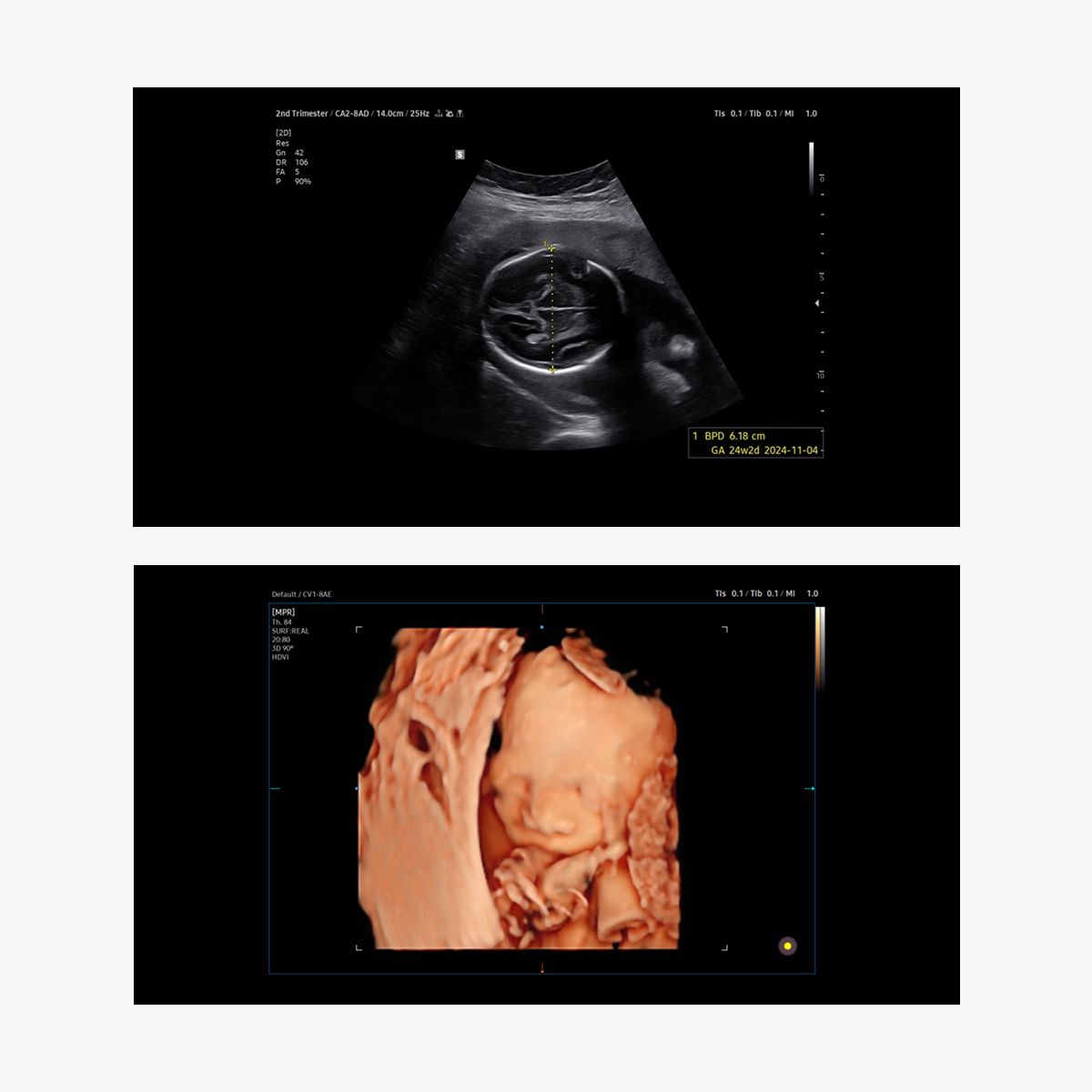 V5 — Ultrasonido diagnóstico de consola con IA