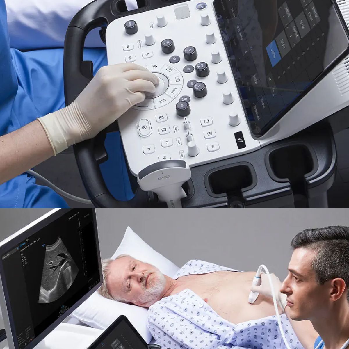 V7 — Sistema de ultrasonido diagnóstico avanzado