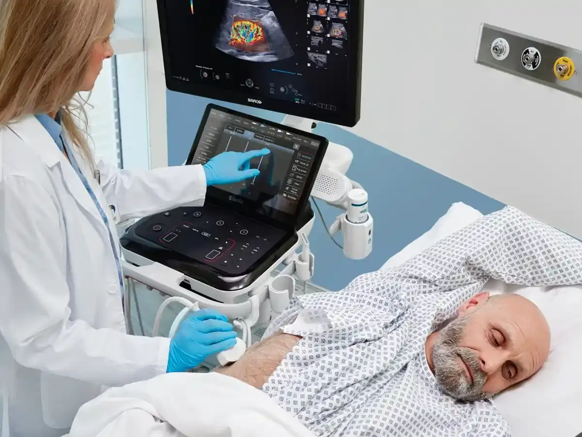 MyLab E80 – Plataforma de ultrasonido premium - Vista 2