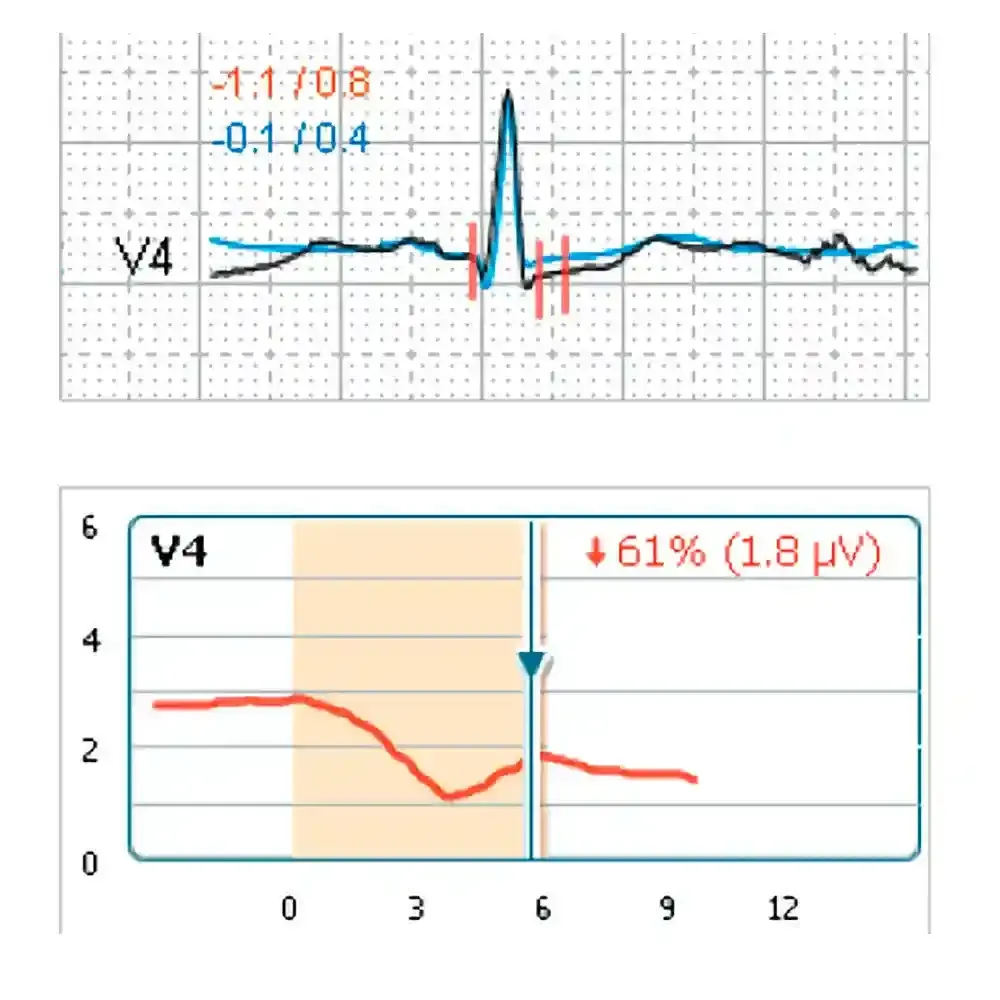 Cardiovit CS-200 Excellence